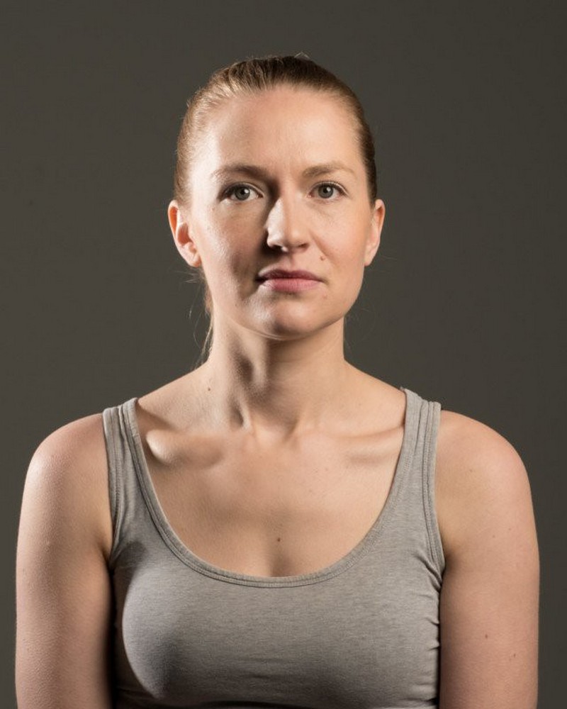 "Nose light" xuất hiện ở cánh mũi bên phải chủ thể.