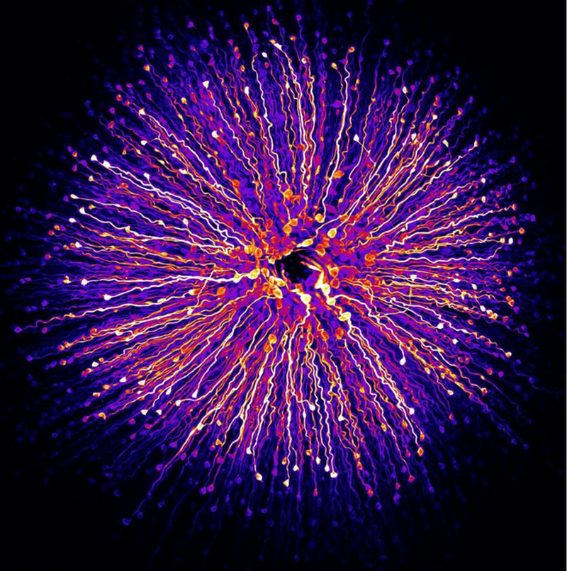 Vị trí thứ 6: Con ngươi của người bởi Hanen Khabou, Pháp.